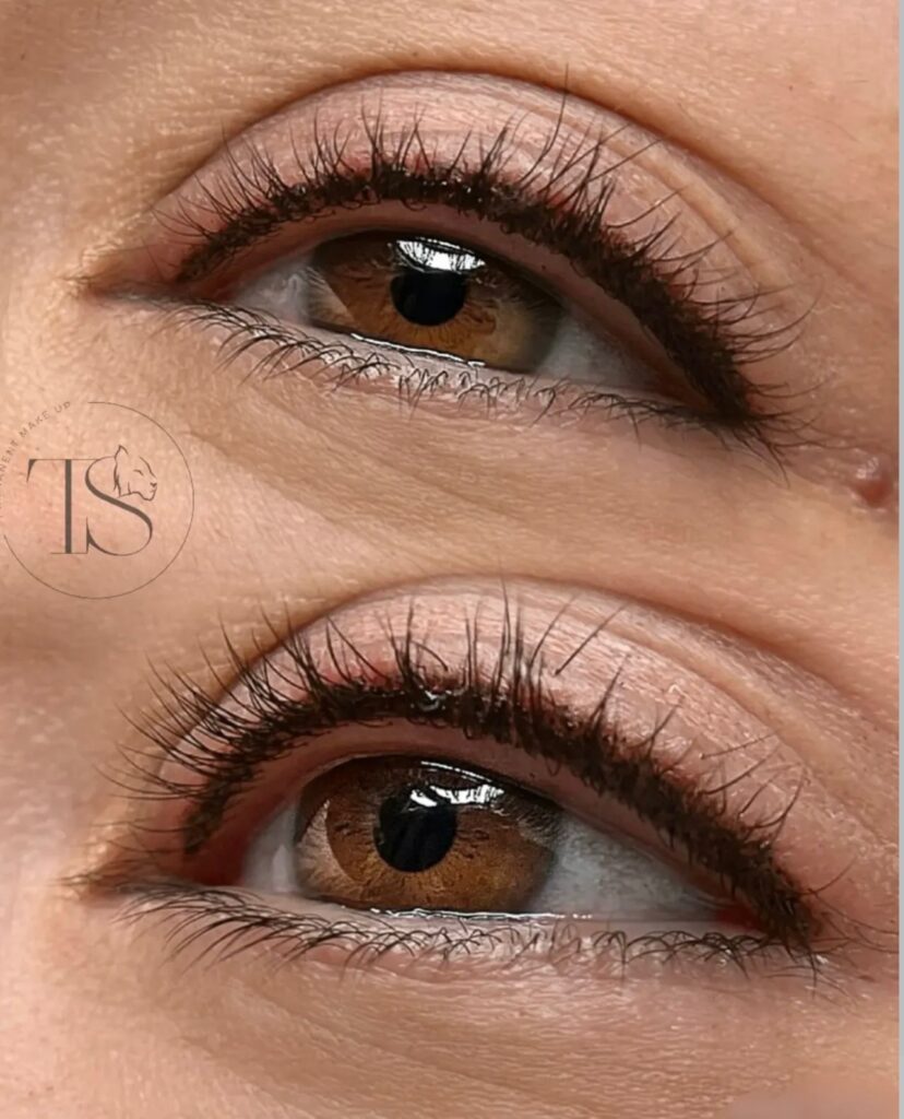 Eyelenir